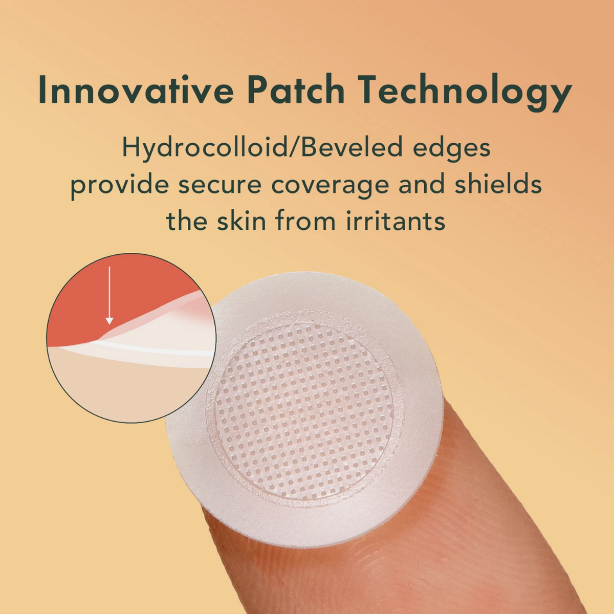 Rael Miracle Patch Microcrystal Vitamin C Dark Spot Cover, Post Acne (9 Count)