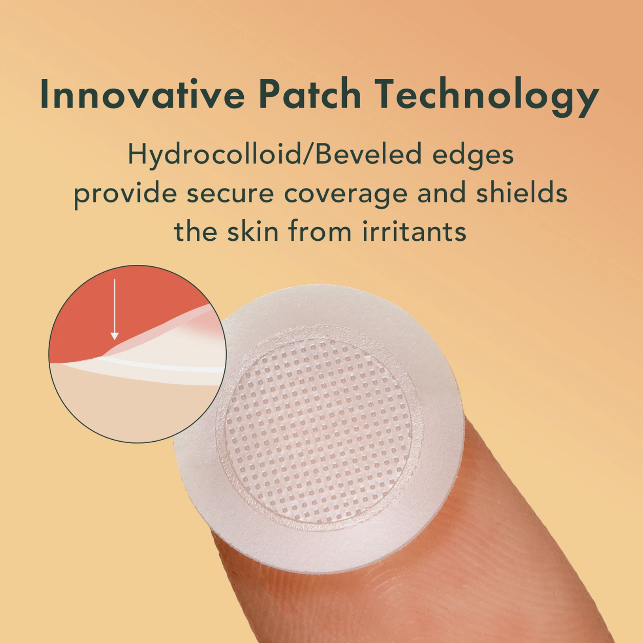 Rael Miracle Patch Microcrystal Vitamin C Dark Spot Cover, Post Acne (9 Count)