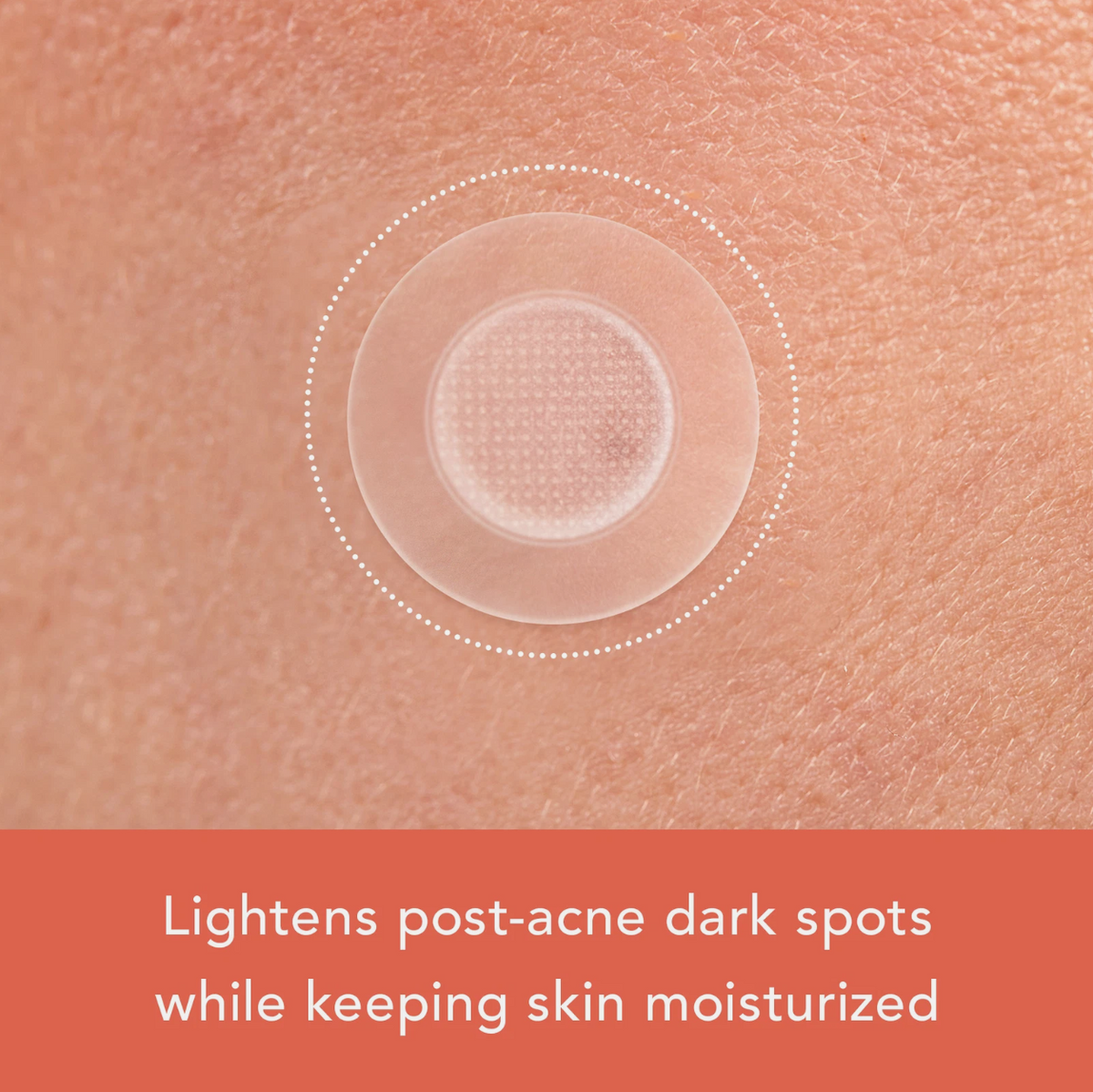 Rael Miracle Patch Microcrystal Vitamin C Dark Spot Cover, Post Acne (9 Count)