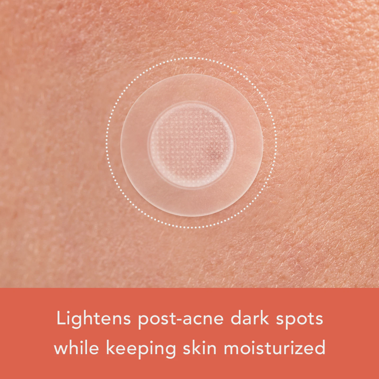 Rael Miracle Patch Microcrystal Vitamin C Dark Spot Cover, Post Acne (9 Count)