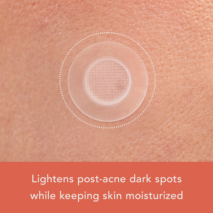 Rael Miracle Patch Microcrystal Vitamin C Dark Spot Cover, Post Acne (9 Count)